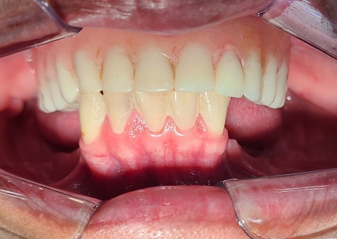 Una mano con comida

Descripción generada automáticamente con confianza baja