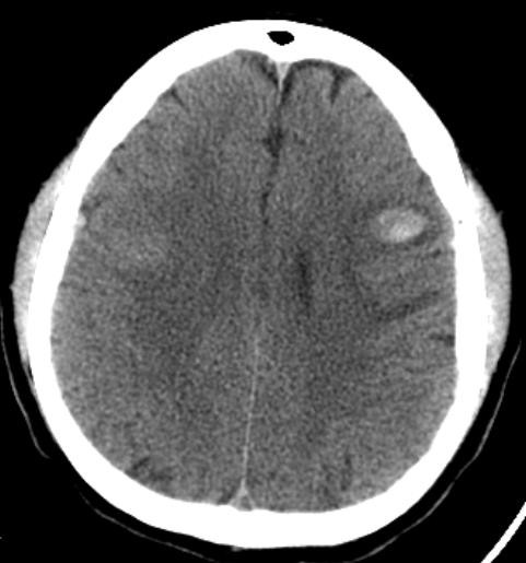 Imagen en blanco y negro de la luna

Descripción generada automáticamente con confianza media
