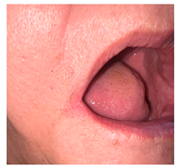 A person's mouth with a tongue sticking out

AI-generated content may be incorrect.